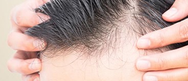 حضور اقاي دكتر كهنموئي در بيستمين كنفرانس ساليانه تازه هاي كاشت مو در آمريكا