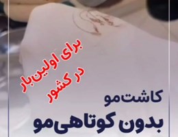 &nbsp; برای اولین بار کاشت موی بلند بدون نیاز به کوتاهی موها توسط اقای دکتر کهنمویی