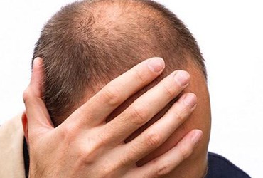  برگزاری کنفرانس اخرین تازه های پیوند مو در دبی برگزاری کنفرانس اخرین تازه های پیوند مو در دبی
