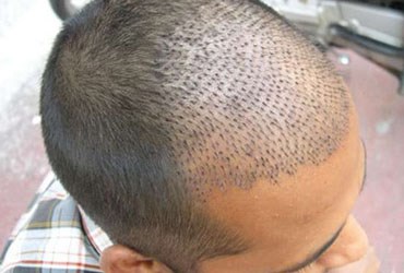 مصاحبه زنده تلویزیونی اقای دکتر کهنمویی